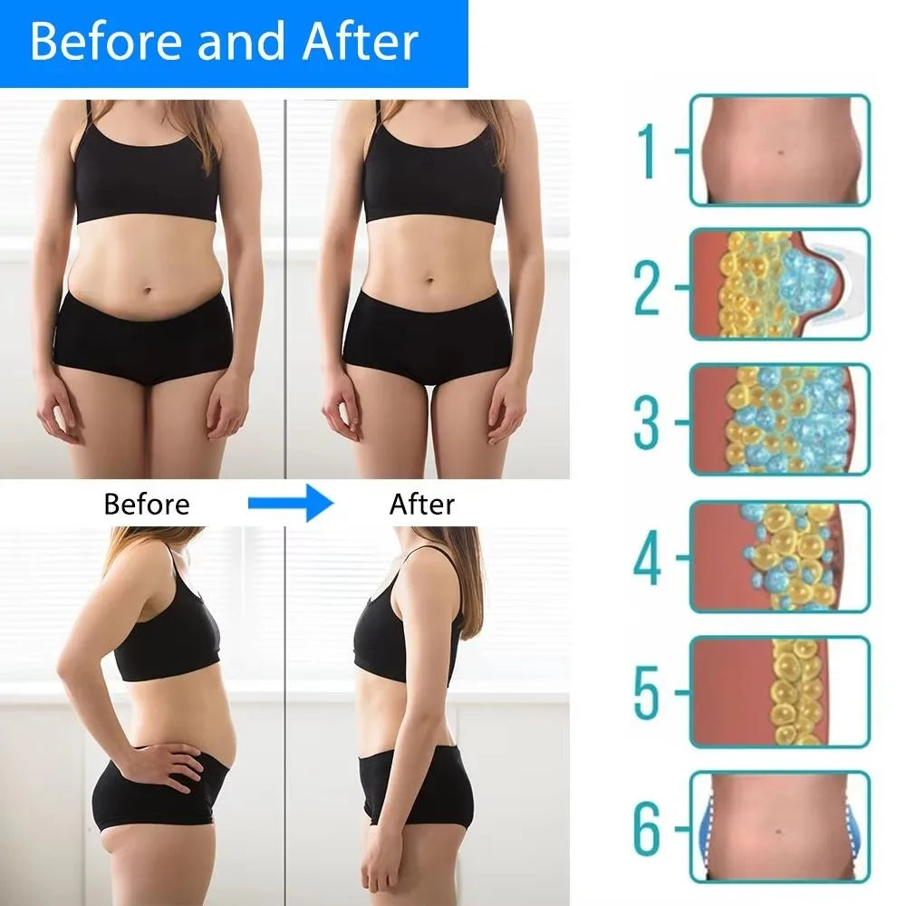 Cryotherapy Body Slimming Massager – Dissolve Fat with Cold Therapy
